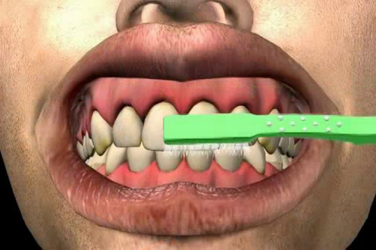 Proceso de cepillado dental para evitar afecciones bucodentales. 