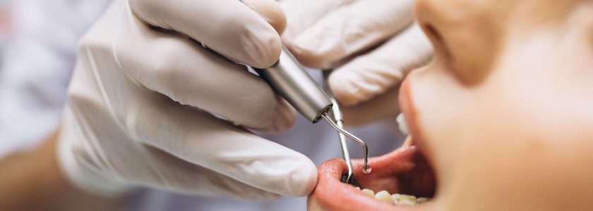 ¿Cómo actuar frente a una urgencia dental? - Clínica Manuel Rosa