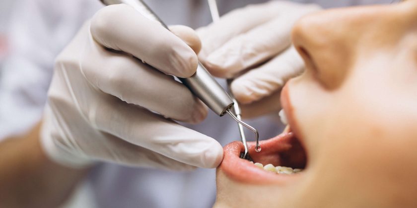 ¿Cómo actuar frente a una urgencia dental? - Clínica Manuel Rosa