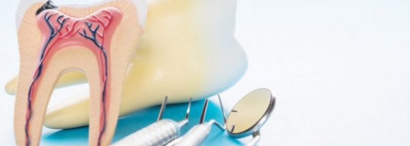 ¿Por qué necesito una endodoncia? - Clínica Manuel Rosa