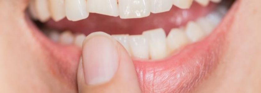 Endodoncia: el tratamiento para salvar tus dientes - Clínica Manuel Rosa