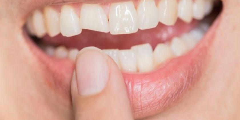 Endodoncia: el tratamiento para salvar tus dientes - Clínica Manuel Rosa